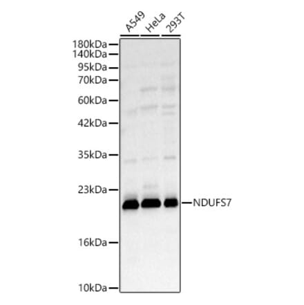Western Blot - Anti-NDUFS7 Antibody (A329667) - Antibodies.com