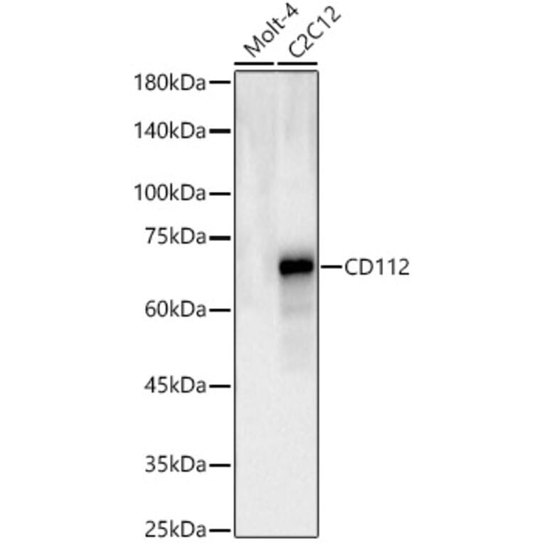 Western Blot - Anti-Nectin 2 Antibody (A329668) - Antibodies.com