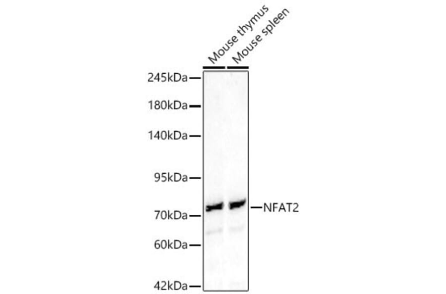 Western Blot - Anti-NFAT2 Antibody (A329671) - Antibodies.com