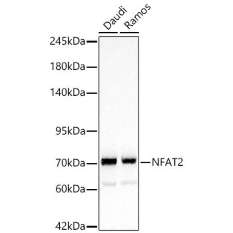 Western Blot - Anti-NFAT2 Antibody (A329671) - Antibodies.com