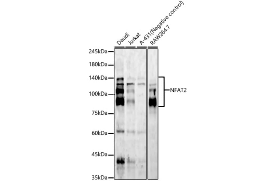 Western Blot - Anti-NFAT2 Antibody [ARC57041] (A329672) - Antibodies.com