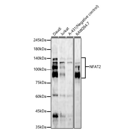 Western Blot - Anti-NFAT2 Antibody [ARC57041] (A329672) - Antibodies.com