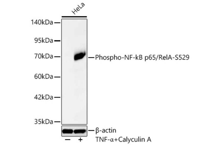 Western Blot - Anti-NF-kB p65 (Phospho S529) Antibody [ARC65114] (A329673) - Antibodies.com
