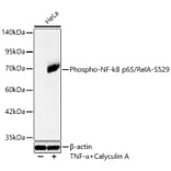 Western Blot - Anti-NF-kB p65 (Phospho S529) Antibody [ARC65114] (A329673) - Antibodies.com
