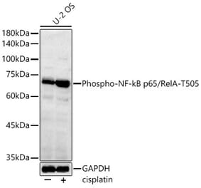 Western Blot - Anti-NF-kB p65 (Phospho T505) Antibody (A329674) - Antibodies.com