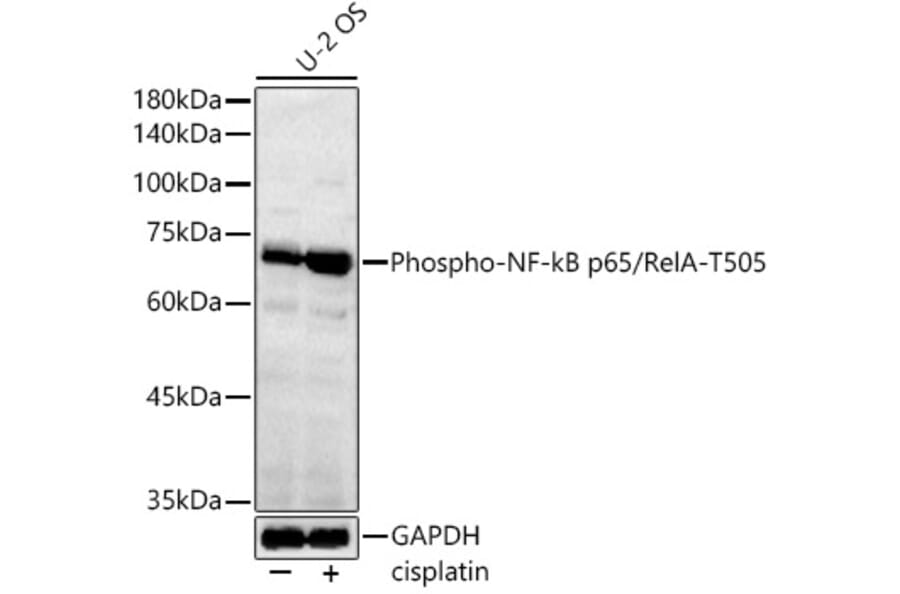 Western Blot - Anti-NF-kB p65 (Phospho T505) Antibody (A329674) - Antibodies.com