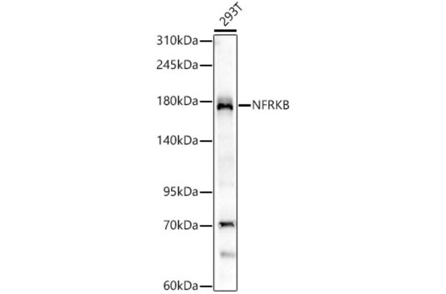 Western Blot - Anti-NFRKB Antibody [ARC62365] (A329675) - Antibodies.com