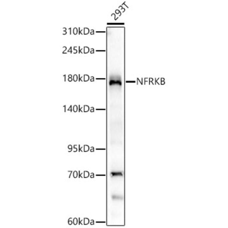 Western Blot - Anti-NFRKB Antibody [ARC62365] (A329675) - Antibodies.com