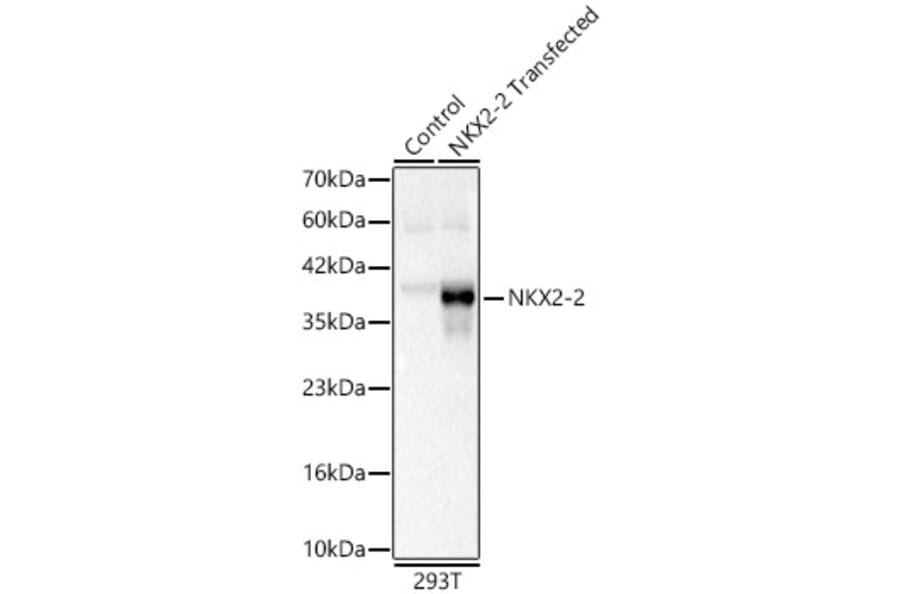Western Blot - Anti-NKX2.2 Antibody (A329678) - Antibodies.com