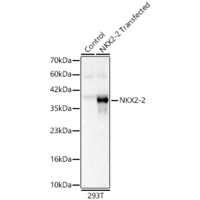 Western Blot - Anti-NKX2.2 Antibody (A329678) - Antibodies.com