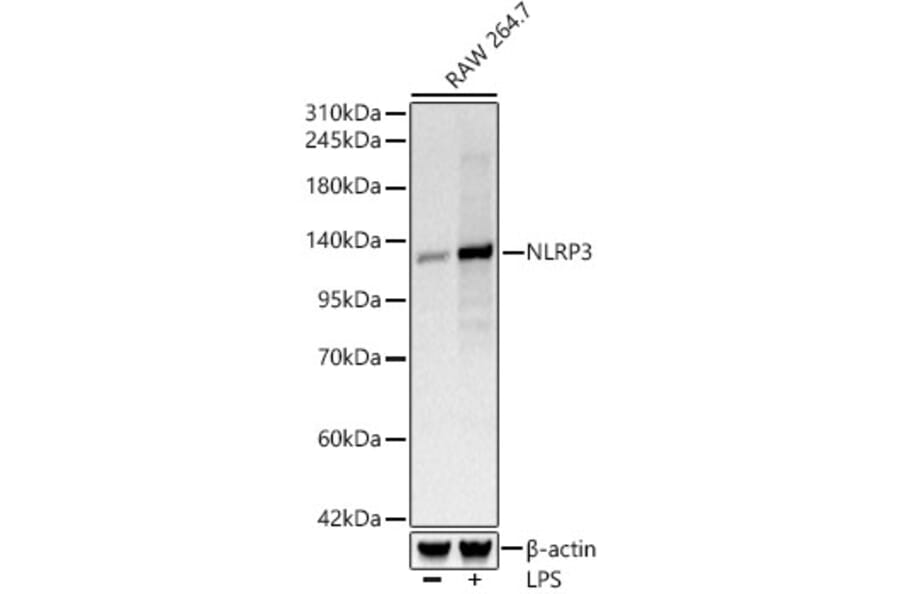 Western Blot - Anti-NLRP3 Antibody [ARC62768] (A329680) - Antibodies.com