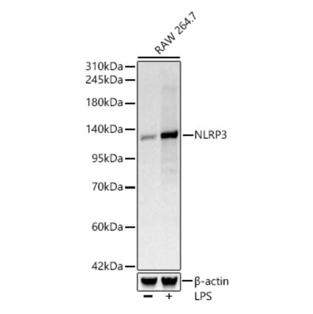 Western Blot - Anti-NLRP3 Antibody [ARC62768] (A329680) - Antibodies.com