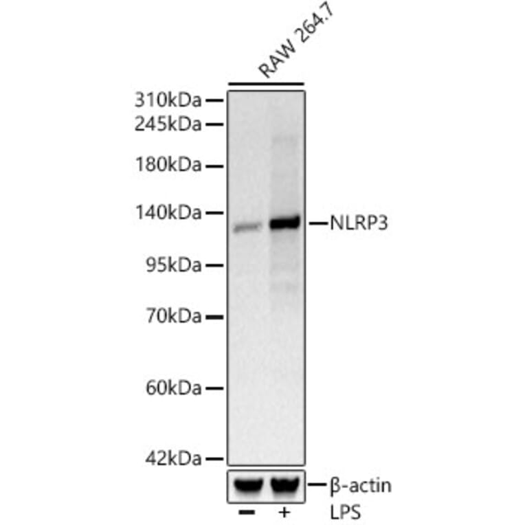 Western Blot - Anti-NLRP3 Antibody [ARC62768] (A329680) - Antibodies.com