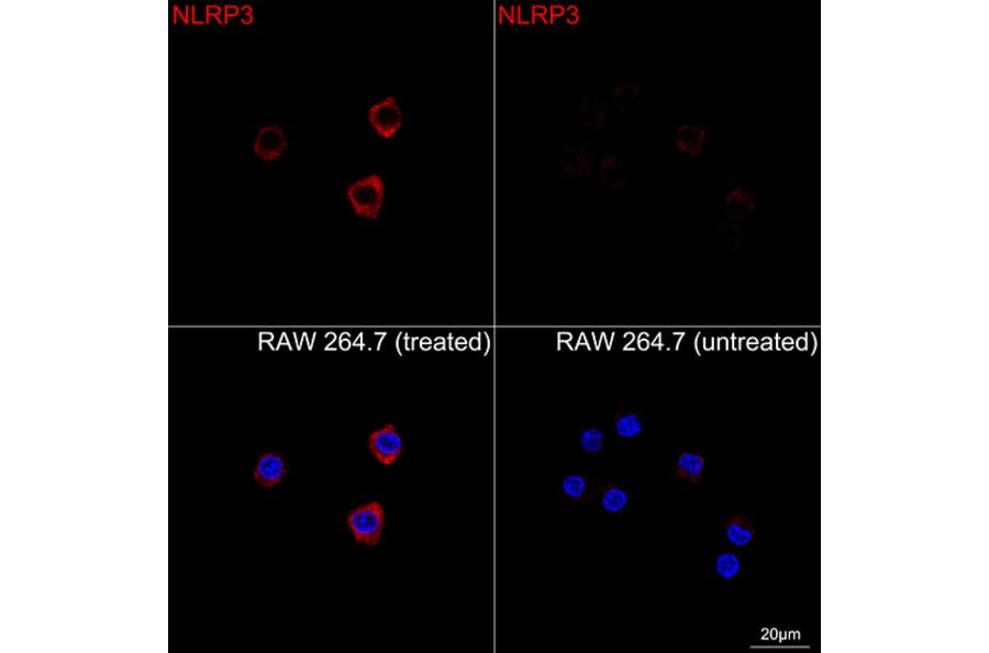 Immunofluorescence - Anti-NLRP3 Antibody [ARC62768] (A329680) - Antibodies.com