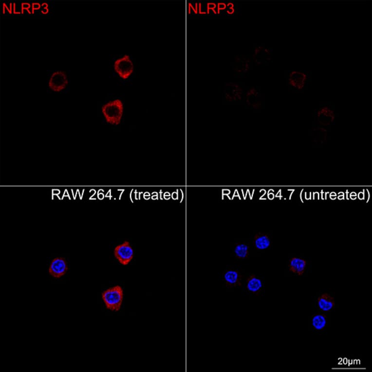 Immunofluorescence - Anti-NLRP3 Antibody [ARC62768] (A329680) - Antibodies.com