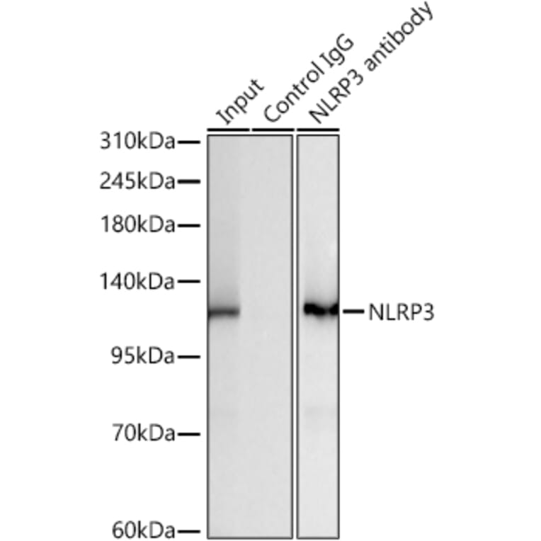 Western Blot - Anti-NLRP3 Antibody [ARC62768] (A329680) - Antibodies.com