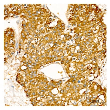 Immunohistochemistry - Anti-NME2 Antibody (A329681) - Antibodies.com