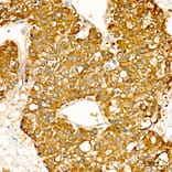 Immunohistochemistry - Anti-NME2 Antibody (A329681) - Antibodies.com