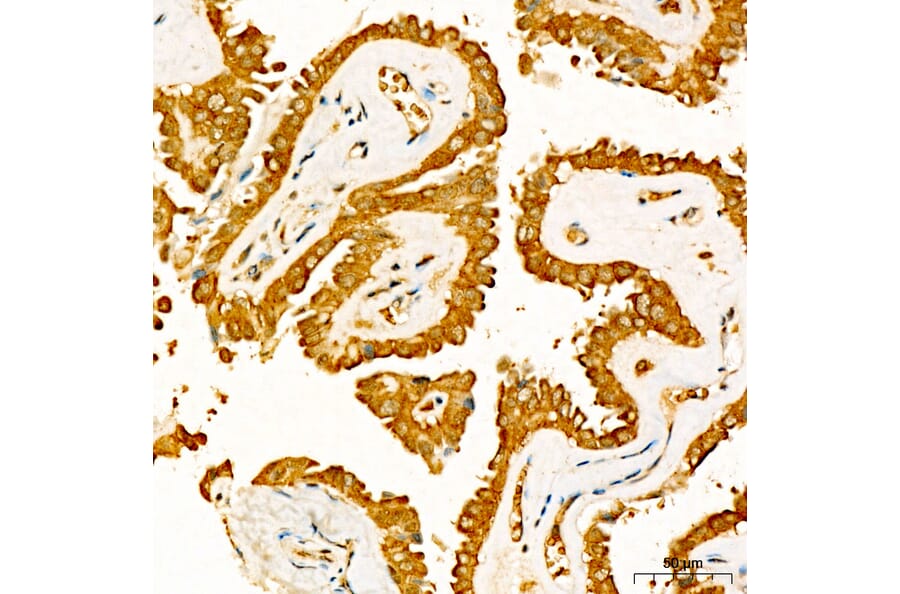 Immunohistochemistry - Anti-NME2 Antibody (A329681) - Antibodies.com