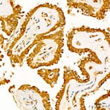 Immunohistochemistry - Anti-NME2 Antibody (A329681) - Antibodies.com