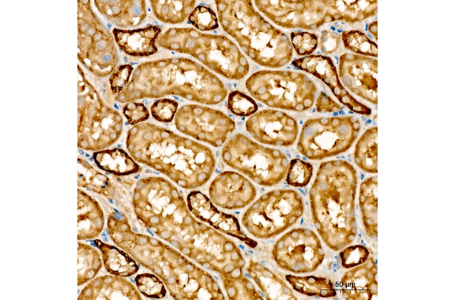 Immunohistochemistry - Anti-NME2 Antibody (A329681) - Antibodies.com