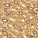 Immunohistochemistry - Anti-NME2 Antibody (A329681) - Antibodies.com