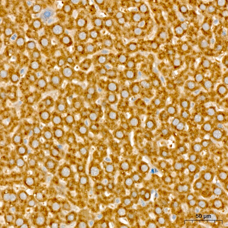 Immunohistochemistry - Anti-NME2 Antibody (A329681) - Antibodies.com