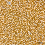 Immunohistochemistry - Anti-NME2 Antibody (A329681) - Antibodies.com