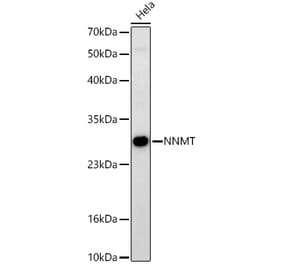 Western Blot - Anti-NNMT Antibody [ARC61849] (A329682) - Antibodies.com