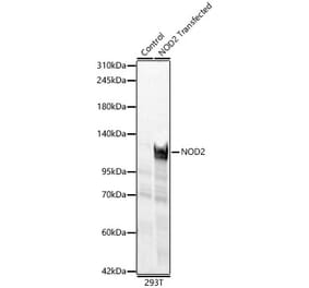 Western Blot - Anti-NOD2 Antibody (A329683) - Antibodies.com