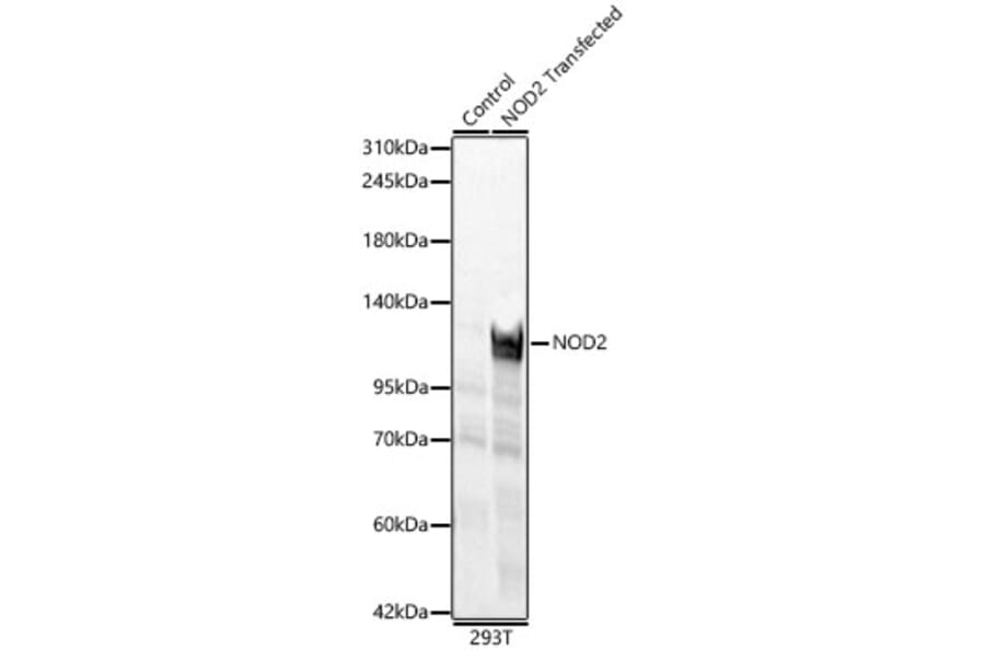 Western Blot - Anti-NOD2 Antibody (A329683) - Antibodies.com