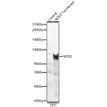 Western Blot - Anti-NOD2 Antibody (A329683) - Antibodies.com