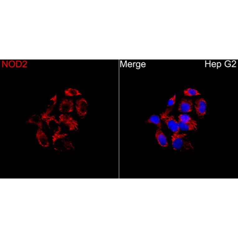 Immunofluorescence - Anti-NOD2 Antibody (A329683) - Antibodies.com