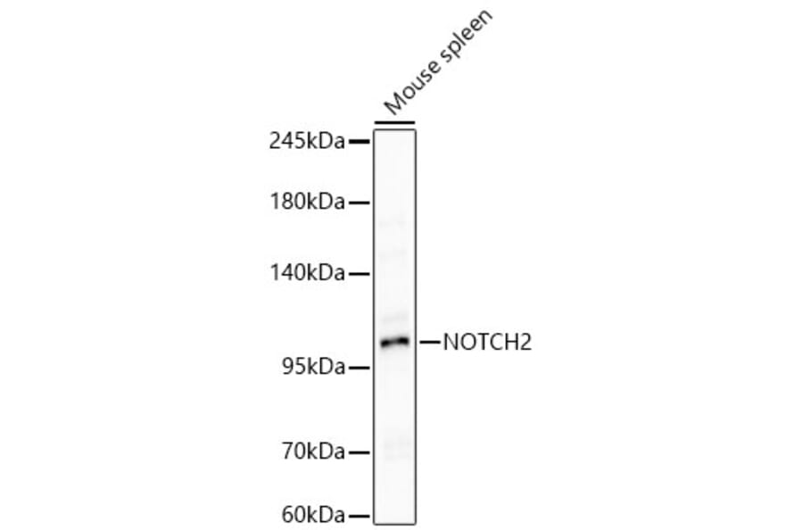 Western Blot - Anti-Notch2 Antibody (A329685) - Antibodies.com