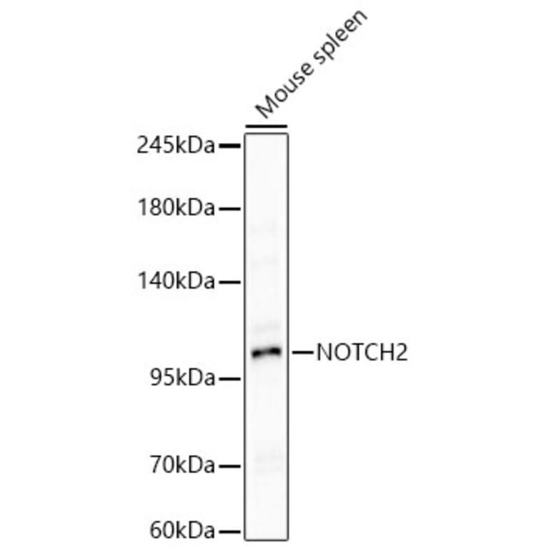Western Blot - Anti-Notch2 Antibody (A329685) - Antibodies.com