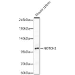 Western Blot - Anti-Notch2 Antibody (A329685) - Antibodies.com