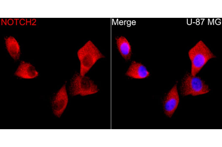 Immunofluorescence - Anti-Notch2 Antibody (A329685) - Antibodies.com