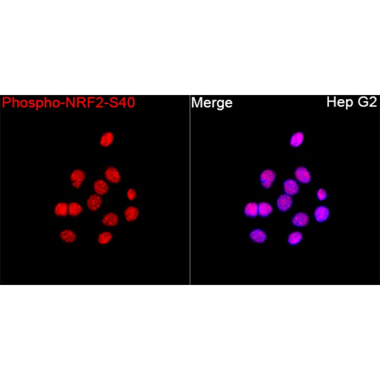 Immunofluorescence - Anti-Nrf2 (Phospho S40) Antibody (A329686) - Antibodies.com