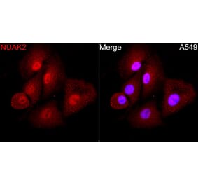 Immunofluorescence - Anti-NUAK2 Antibody (A329688) - Antibodies.com