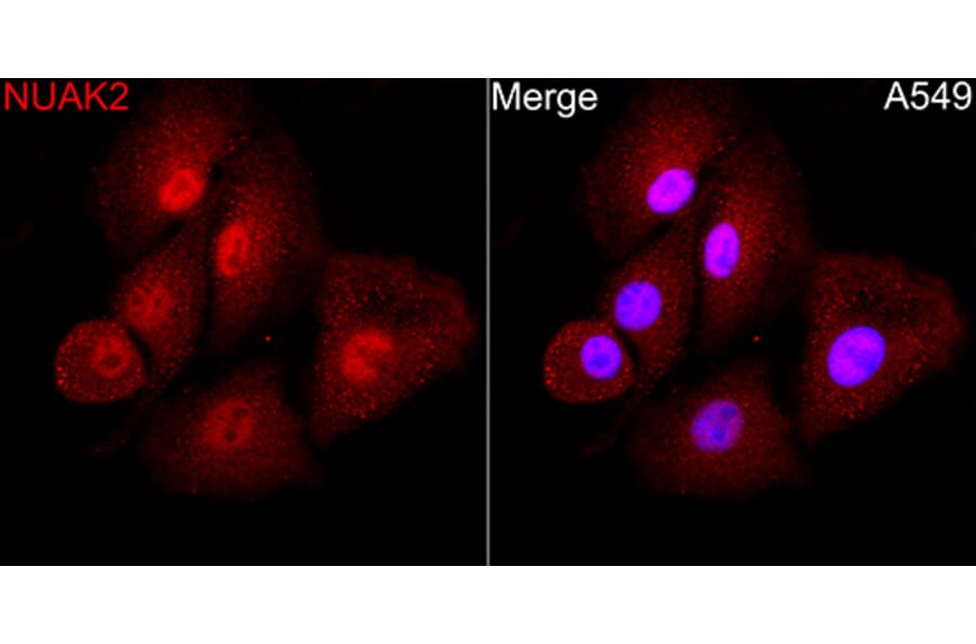 Immunofluorescence - Anti-NUAK2 Antibody (A329688) - Antibodies.com