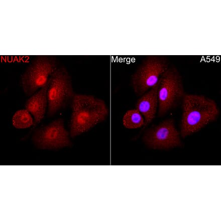 Immunofluorescence - Anti-NUAK2 Antibody (A329688) - Antibodies.com