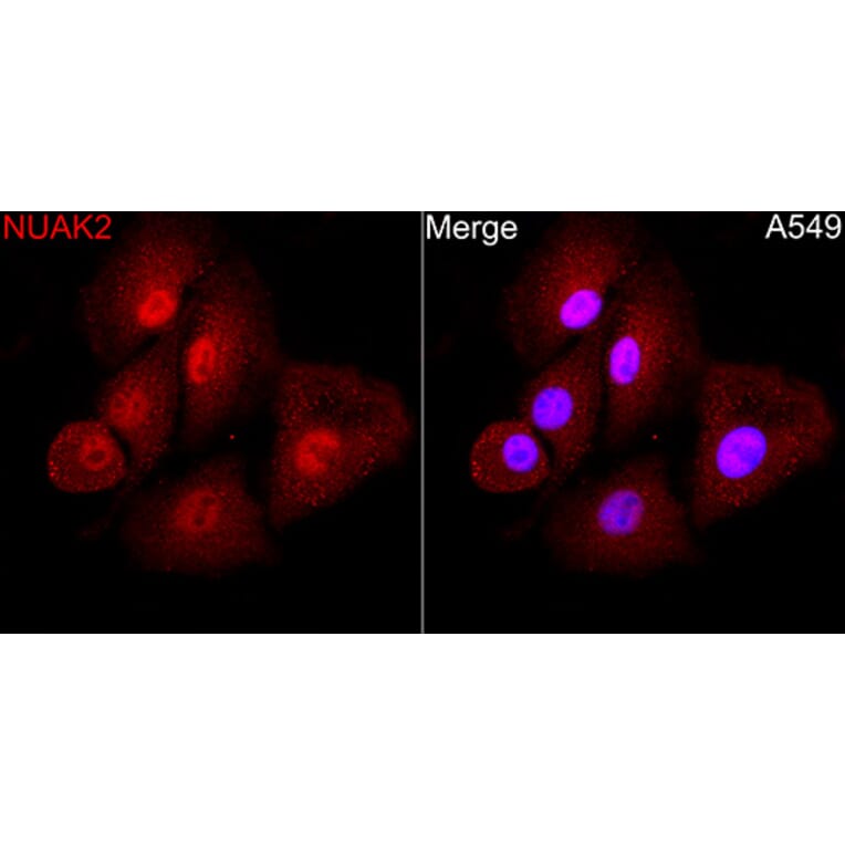 Immunofluorescence - Anti-NUAK2 Antibody (A329688) - Antibodies.com
