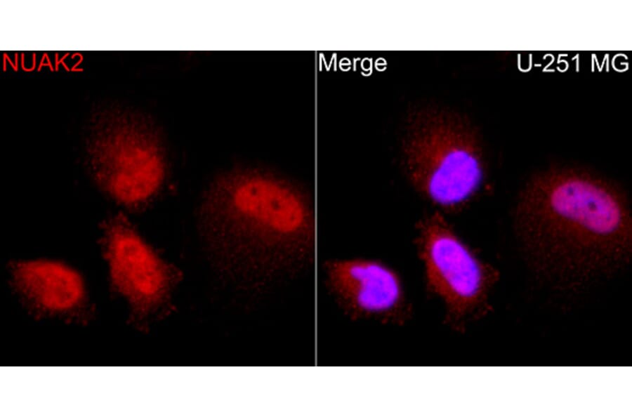 Immunofluorescence - Anti-NUAK2 Antibody (A329688) - Antibodies.com
