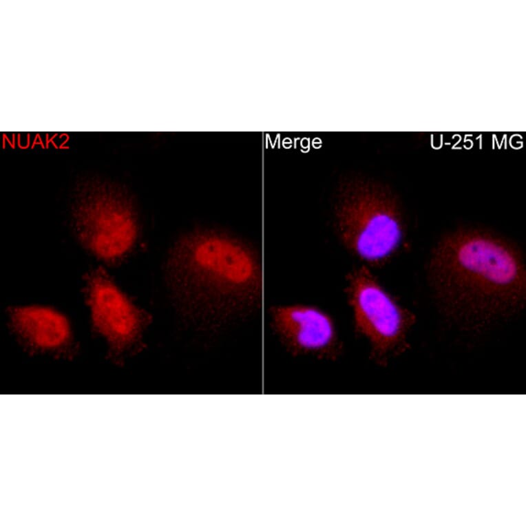 Immunofluorescence - Anti-NUAK2 Antibody (A329688) - Antibodies.com