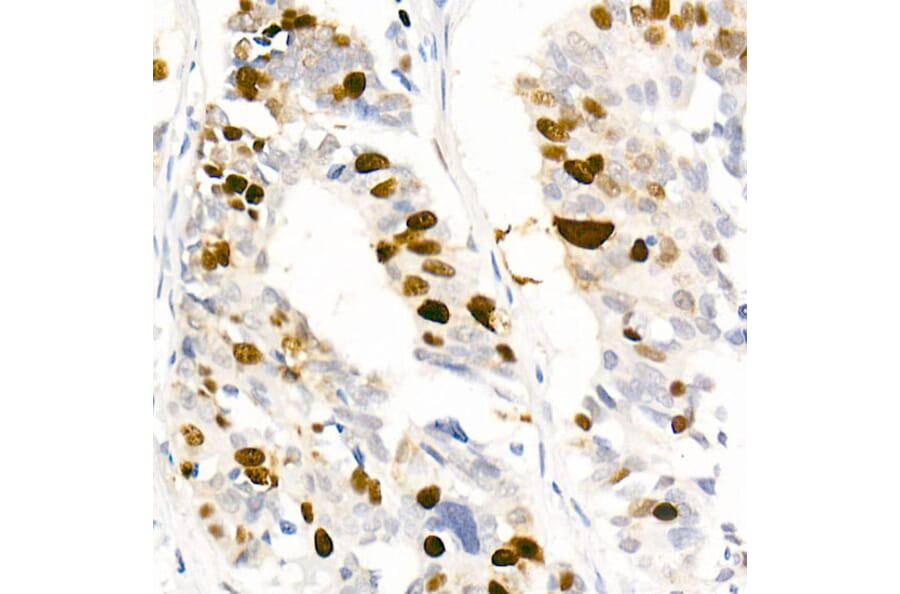 Immunohistochemistry - Anti-Nucleolin (Phospho T76) Antibody [ARC2906] (A329690) - Antibodies.com