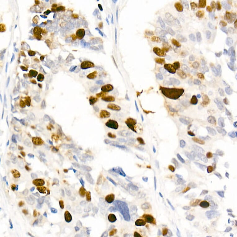 Immunohistochemistry - Anti-Nucleolin (Phospho T76) Antibody [ARC2906] (A329690) - Antibodies.com