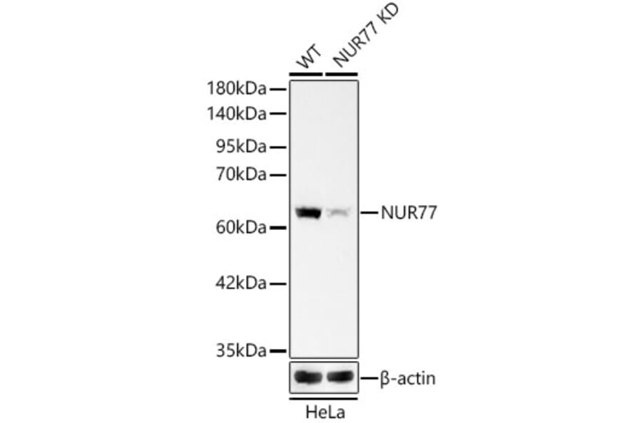 Western Blot - Anti-Nur77 Antibody [ARC58221] (A329691) - Antibodies.com