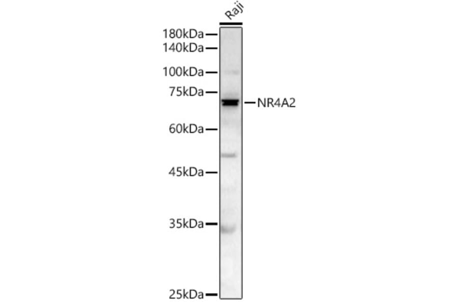 Western Blot - Anti-Nurr1 Antibody (A329692) - Antibodies.com