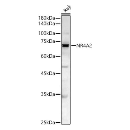 Western Blot - Anti-Nurr1 Antibody (A329692) - Antibodies.com