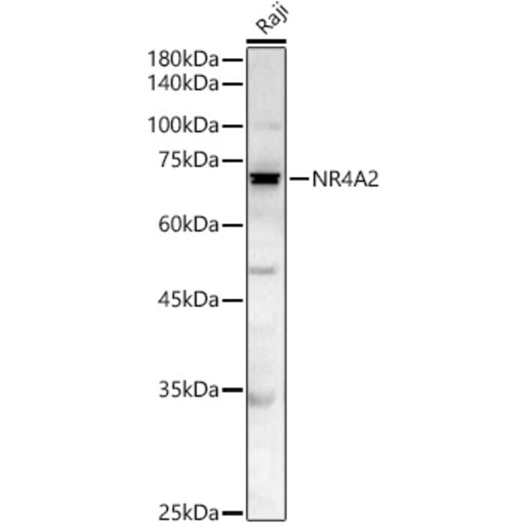 Western Blot - Anti-Nurr1 Antibody (A329692) - Antibodies.com